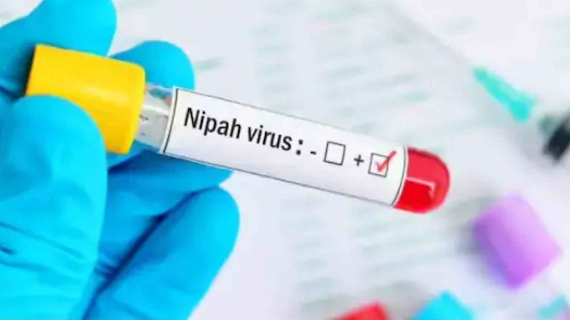भारत में निपाह वायरस का पहला जानलेवा मामला दर्ज !